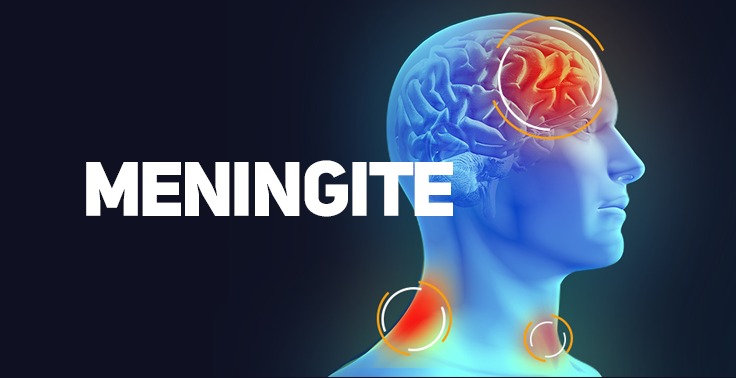 Aumento de casos de meningite acende sinal de alerta na área de saúde